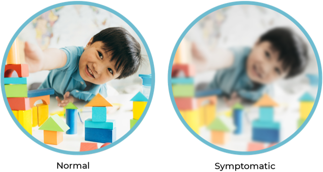 Comparison of normal and symptomatic vision